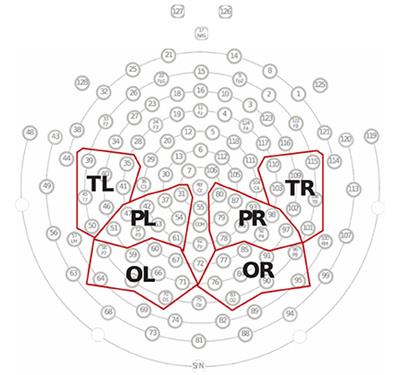 Resting-state EEG reveals global network deficiency in prelingually deaf children with late cochlear implantation